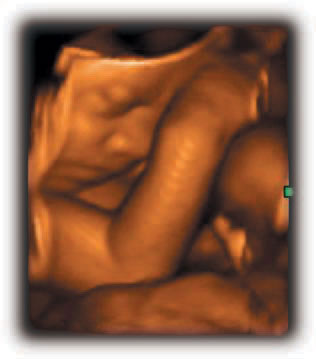 Top-2010-Health-3D-Ultrasound